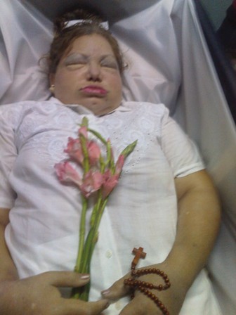 Ultima foto del cuerpo de Laura Pollán, tomada por el Rev. Ricardo Santiago Medina Salabarría
